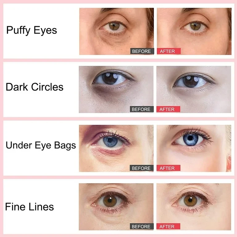 Sadoer Skin Firming Dark Circle Fading Anti-wrinkle Retinol Eye Cream Stick 3g