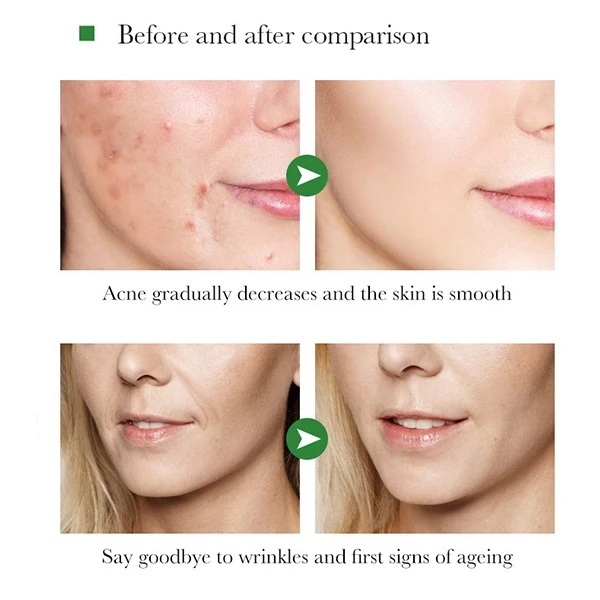 3Pcs Skin Care Face Serum Snail Serum Facial Moisturizing Anti Wrinkle Skin Repa