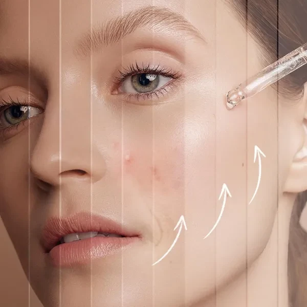 Skin Repair Freckle Whitening Face Serum Dull Skin Dark Spots Brightening Skin S