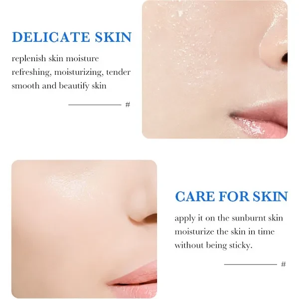 Care Face Moisturizing Gel Cream Sadoer Vitamin E Hydrating Facial Anti-acne Soo