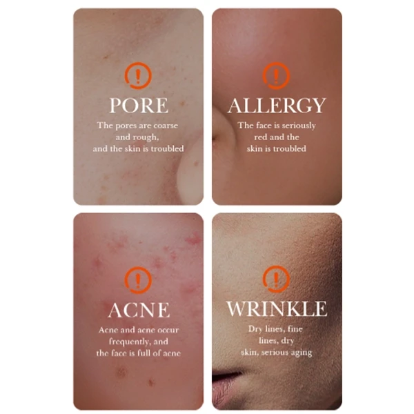 Nourishing Skin Care Serum Brightening Skin Moisturizing Serum Acne Pore Repair