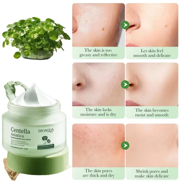 Centella Asiatica Anti-Acne Oil Control Personal Care Nourish Skin Repair Face C