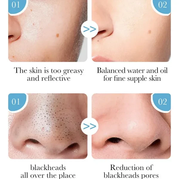 Aloe Vera Face Gel Soothing Moisture Repair Skin Brighten Reduce Acne Lightening