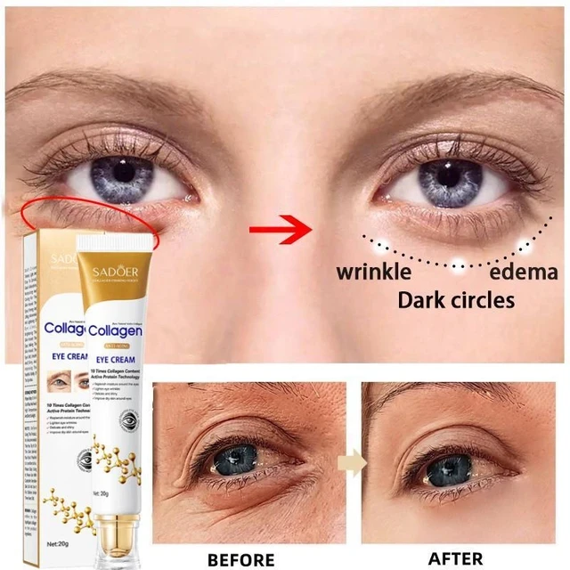 Firm Collagen Moisturizing Anti-aging Eye Cream for Black Circles Fades Fine Lin