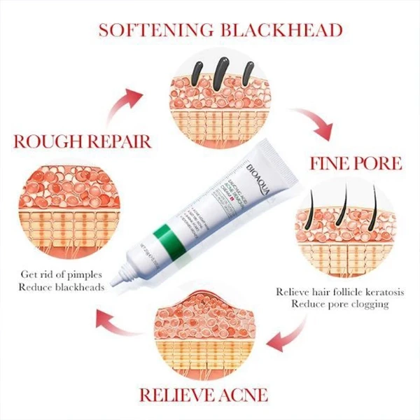 Salicylic Acid High Pigmented Skin Care Anti-Acne Removal Cream Facial Cleanser