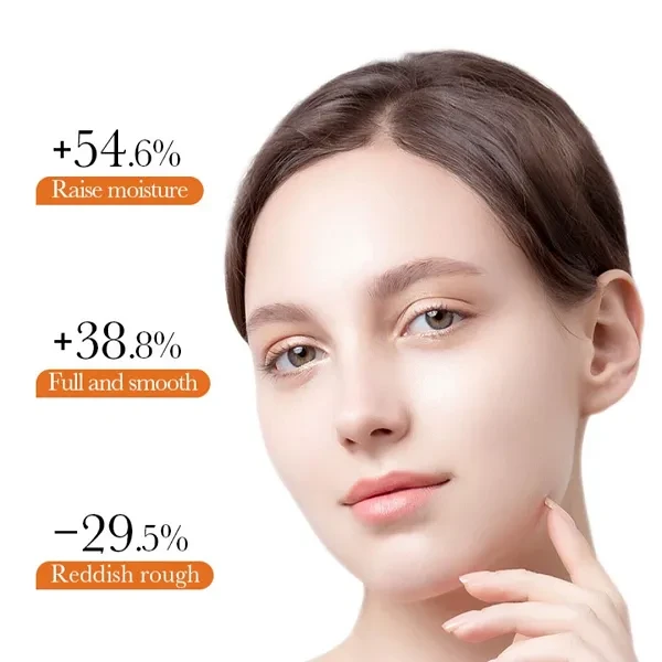 Sadoer Turmeric Antioxygen Repair Face Cream Nourishing Lotion Acne Removing Cle