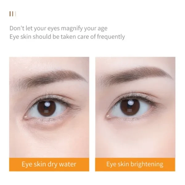 Vitamin C Brightening Eye Cream Smooth Skin Dark Cricle Remover Lighten Face Moi