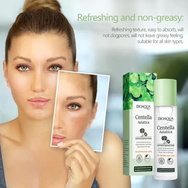 BIOAQUA Centella Asiatica Oil Control Skin Improvement Facial Care Skin Quick Re