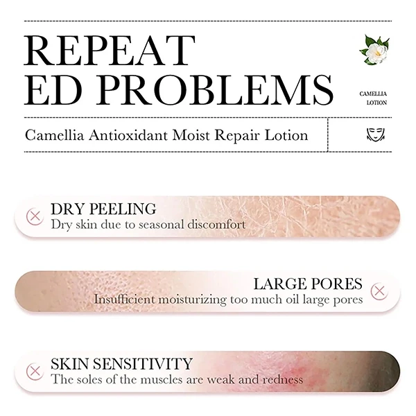 Camellias Facial Care Anti-Aging Glowing Anti-Oxidation Skincare Moist Repair Lo