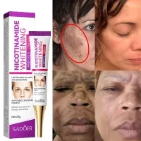 Freckle Removal Cream Whitening Lighten Dullness Dark Spot Remover Soft Skin Moi