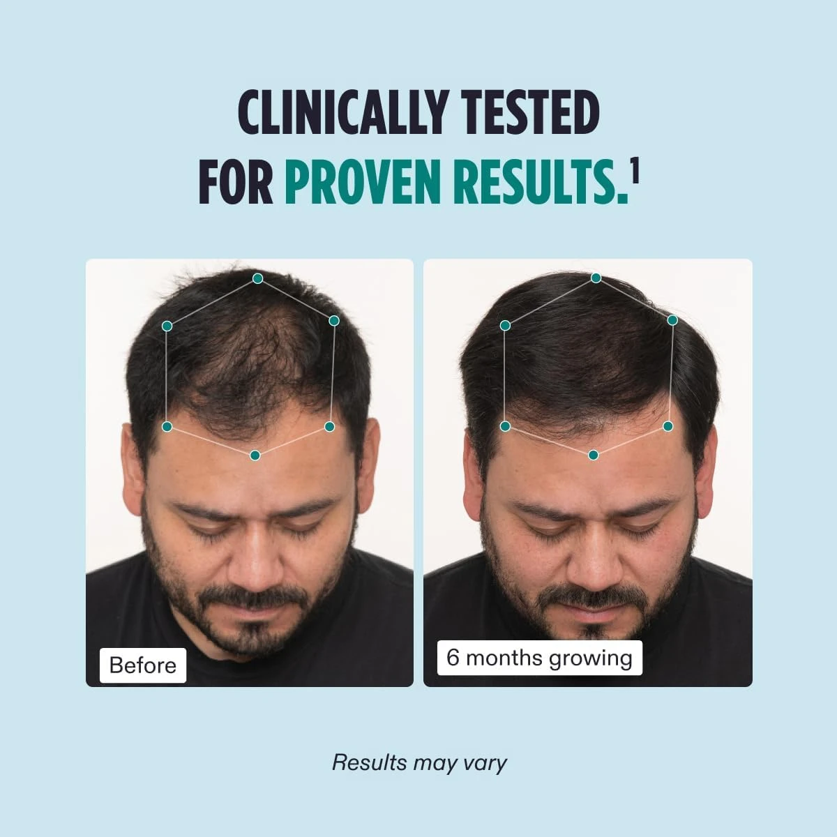 Nutrafol Men's Hair Growth Supplements, Clinically Tested for Visibly Thicker Ha