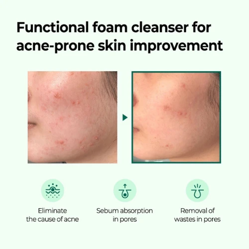 SOME BY MI "" AHA.BHA.PHA 30 Days Miracle Foam (100 ml)