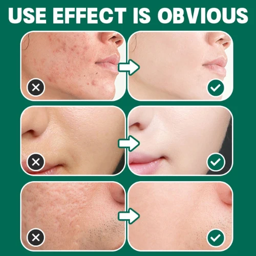 SOME BY MI "" AHA.BHA.PHA 30 Days Miracle Foam (100 ml)