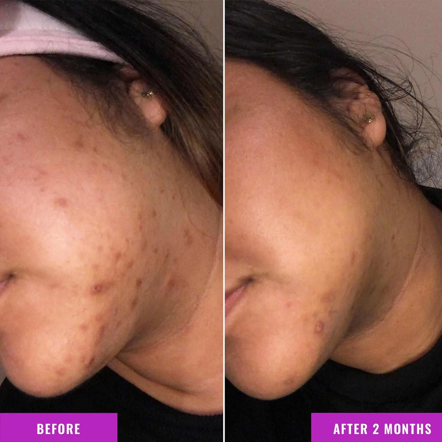 GOOD MOLECULES Discoloration Correcting Serum