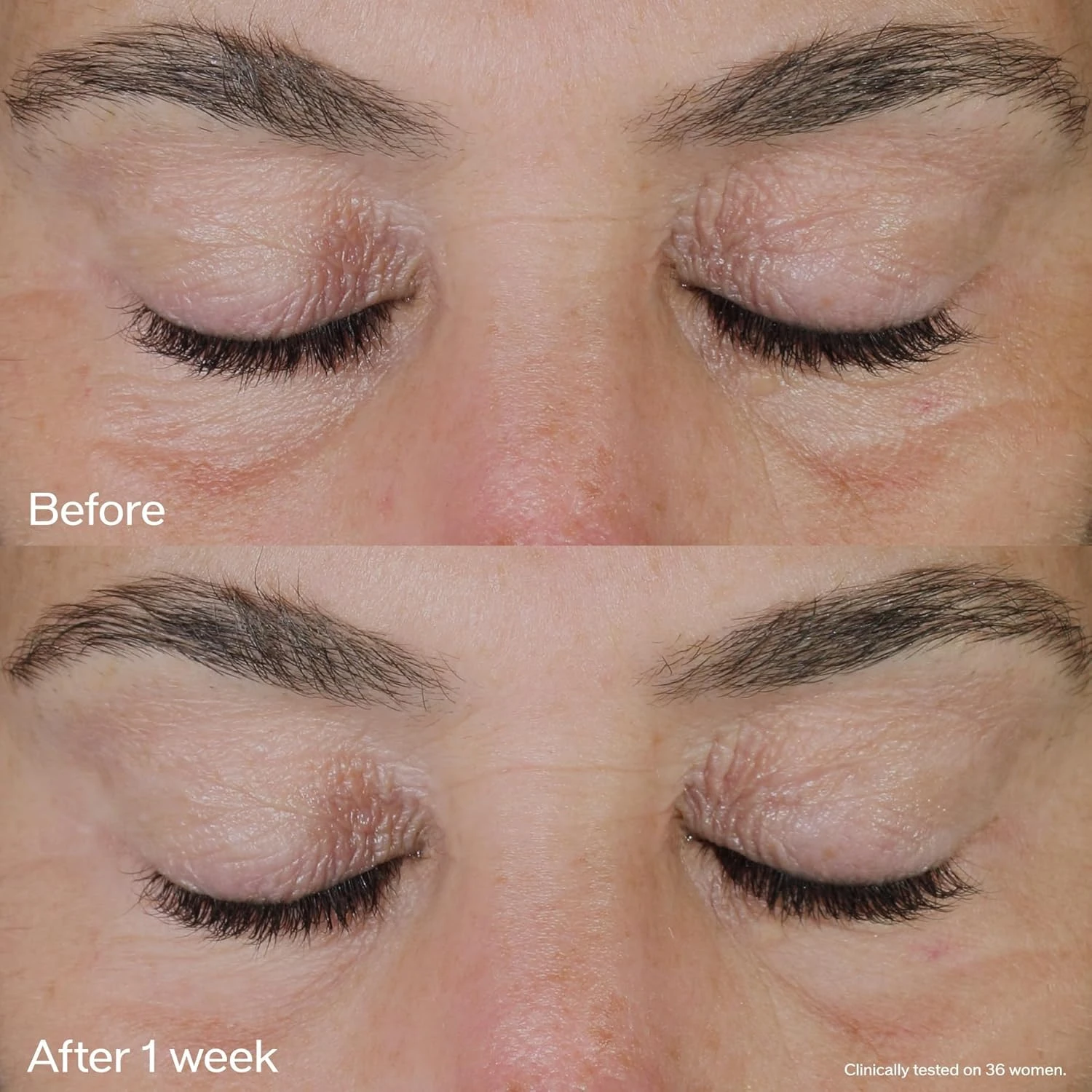 Shiseido Vital Perfection Uplifting And Firming Eye Cream 15 Ml