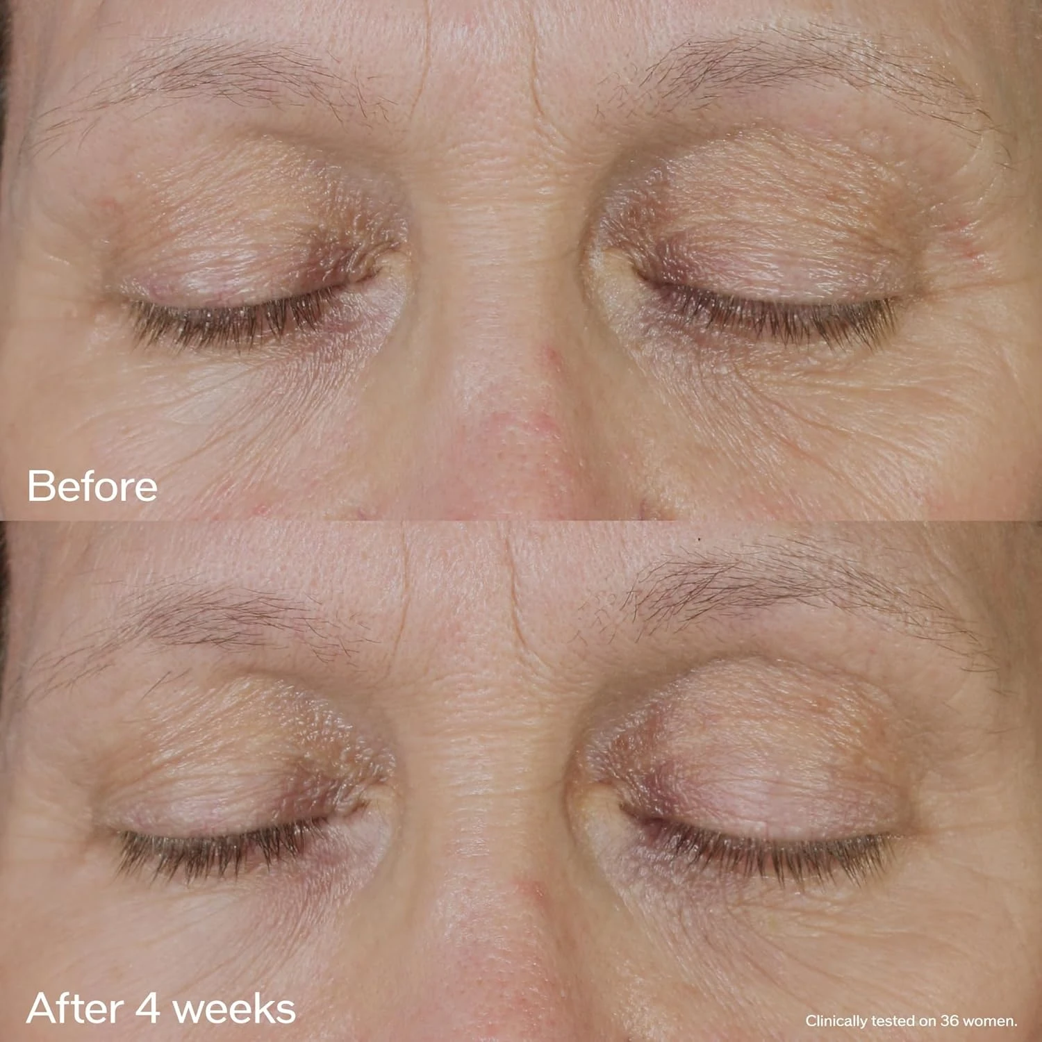 Shiseido Vital Perfection Uplifting And Firming Eye Cream 15 Ml