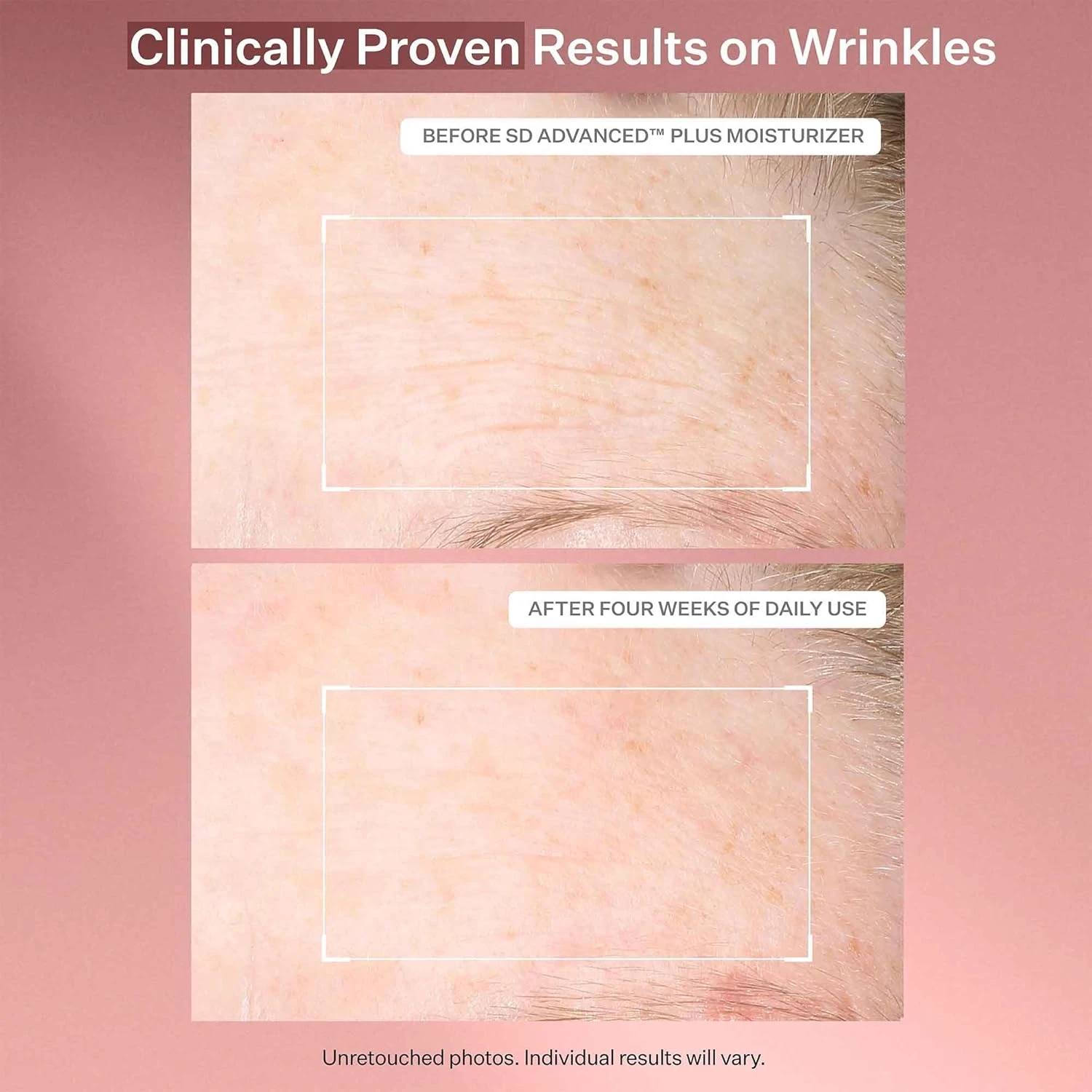 StriVectin Anti Wrinkle Trio Kit for Face & Eyes, 3 piece kit with SD Plus Moist