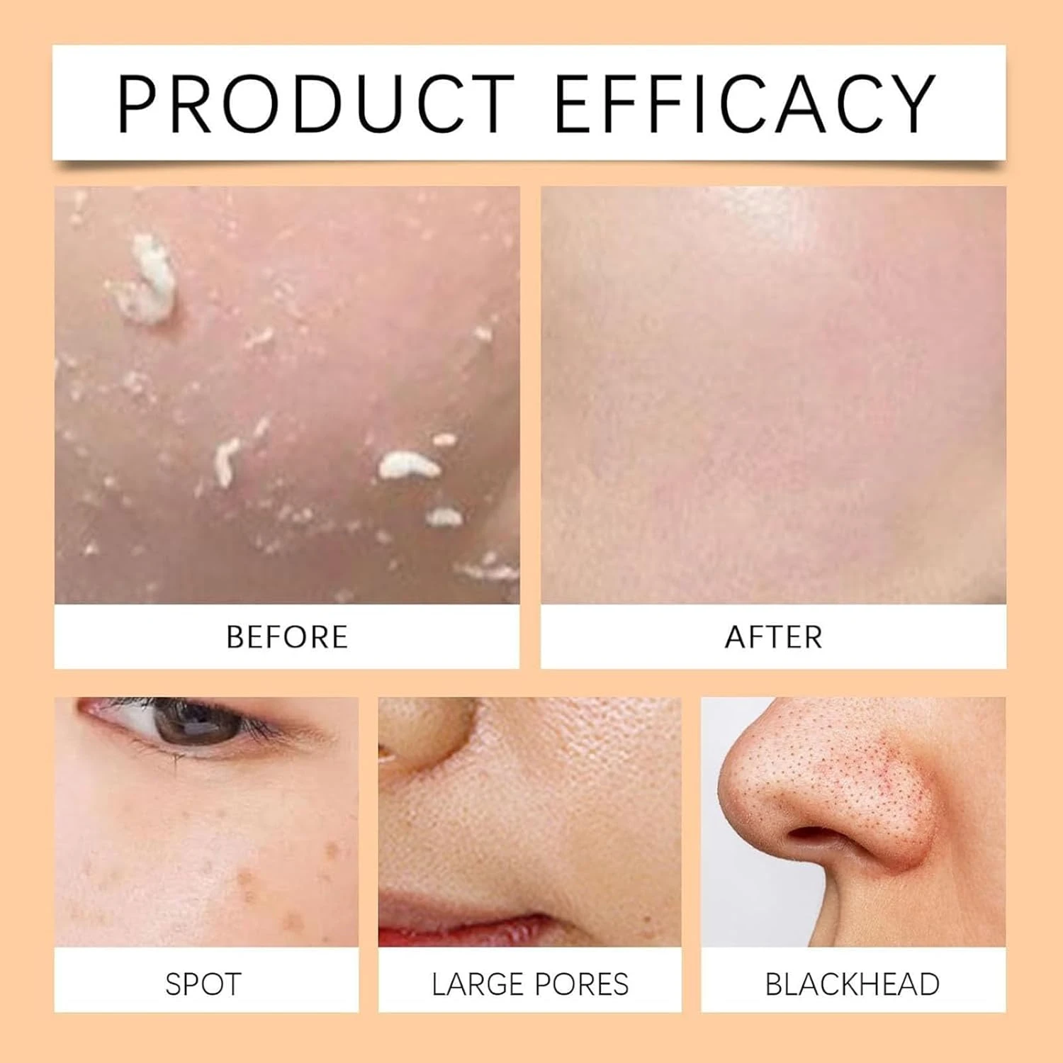 377 Anti-Wrinkle Cream, Dark Spot Corrector Face Cream, 377 Whitening Cream Anti