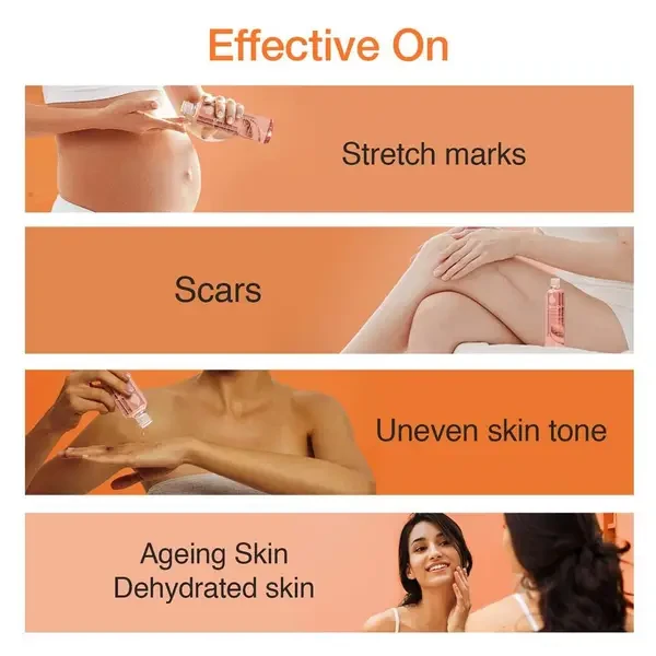 Bio-Oil Skincare oil| Specialist for Scar and Stretch marks,Uneven Skin tone, Ag
