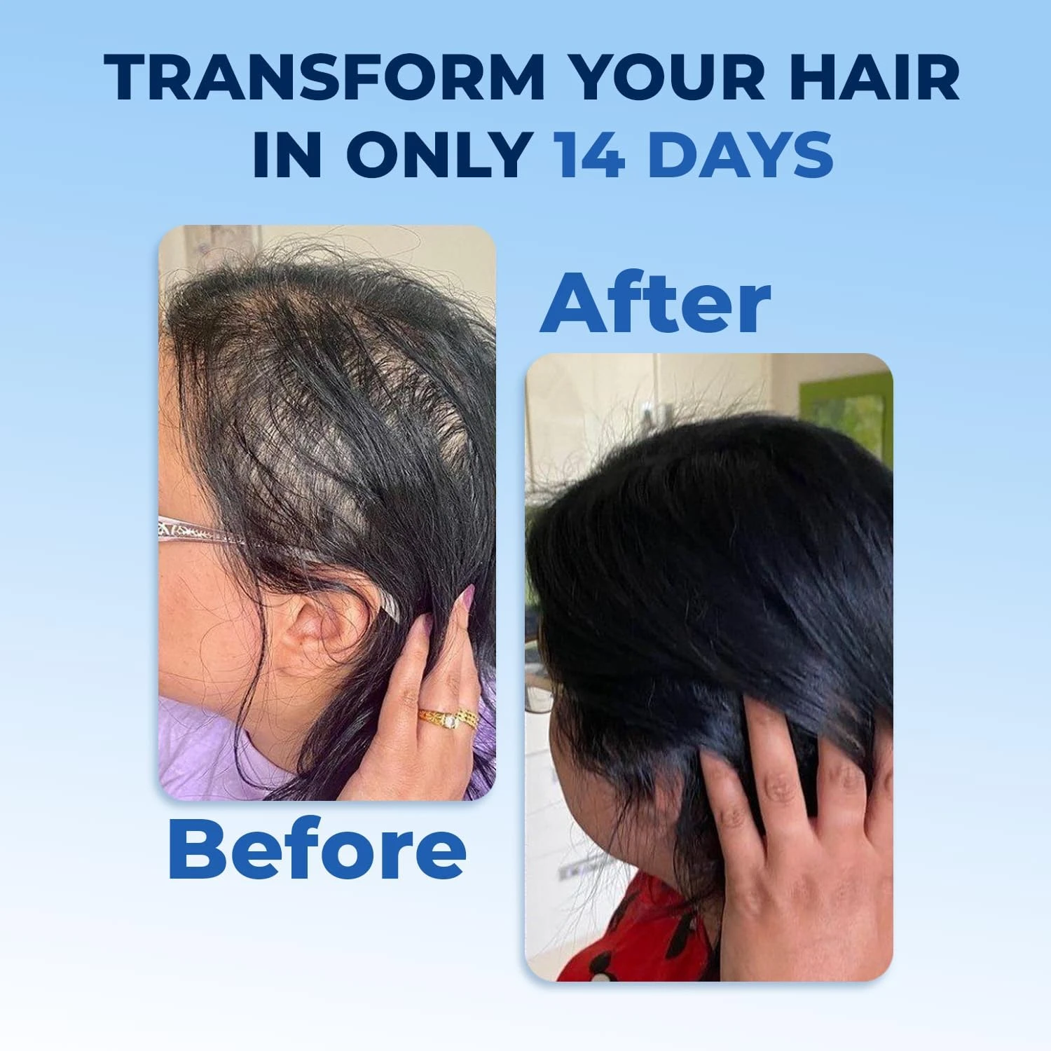 FEGPLUS Rosemary Beard & Hair Growth Serum (50ml), Rosemary Extract Serum Hair S