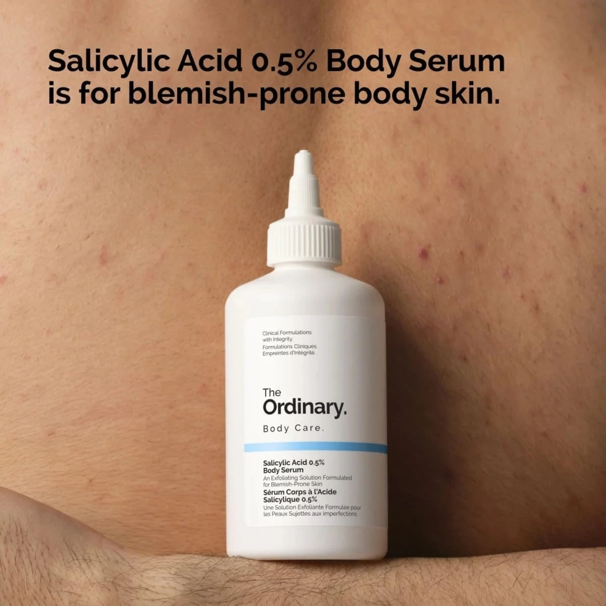 The Ordinary Salicylic Acid 0.5% Body Serum (240ml) – Exfoliating Treatment for 