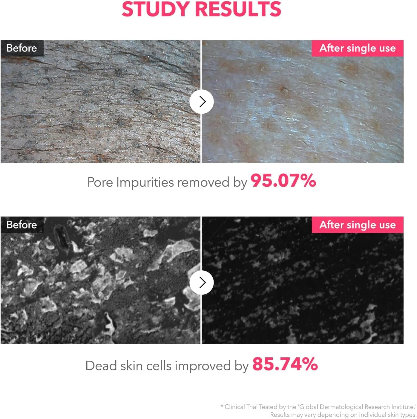 APRILSKIN TXA Niacinamide 99 Pore Care Pink Bubble Gum Deep Cleanser | 99% High-