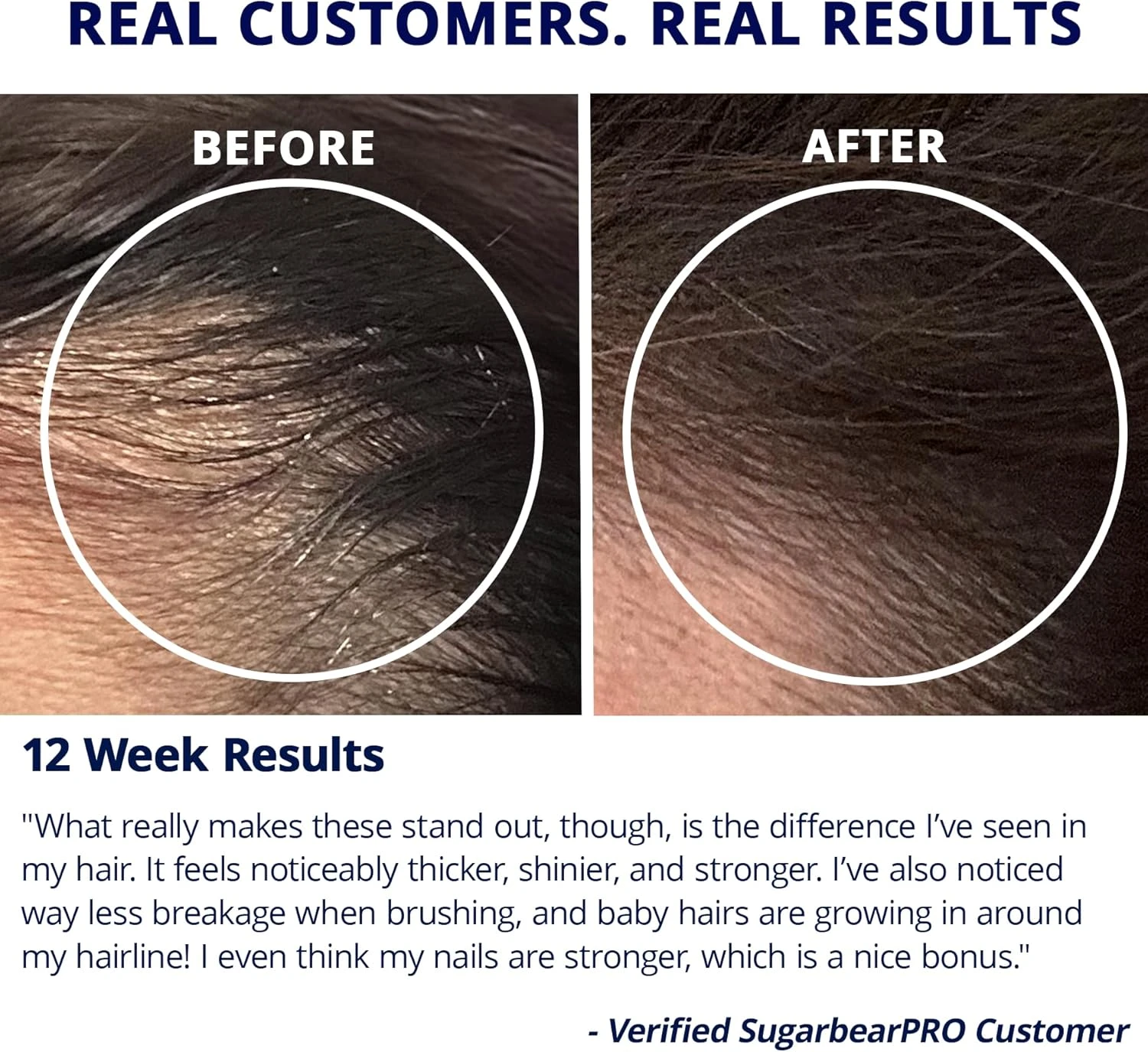 Sugarbear Pro Hair Vegan Vitamin Gummies for Luscious Halal Vegan with Vitamin C