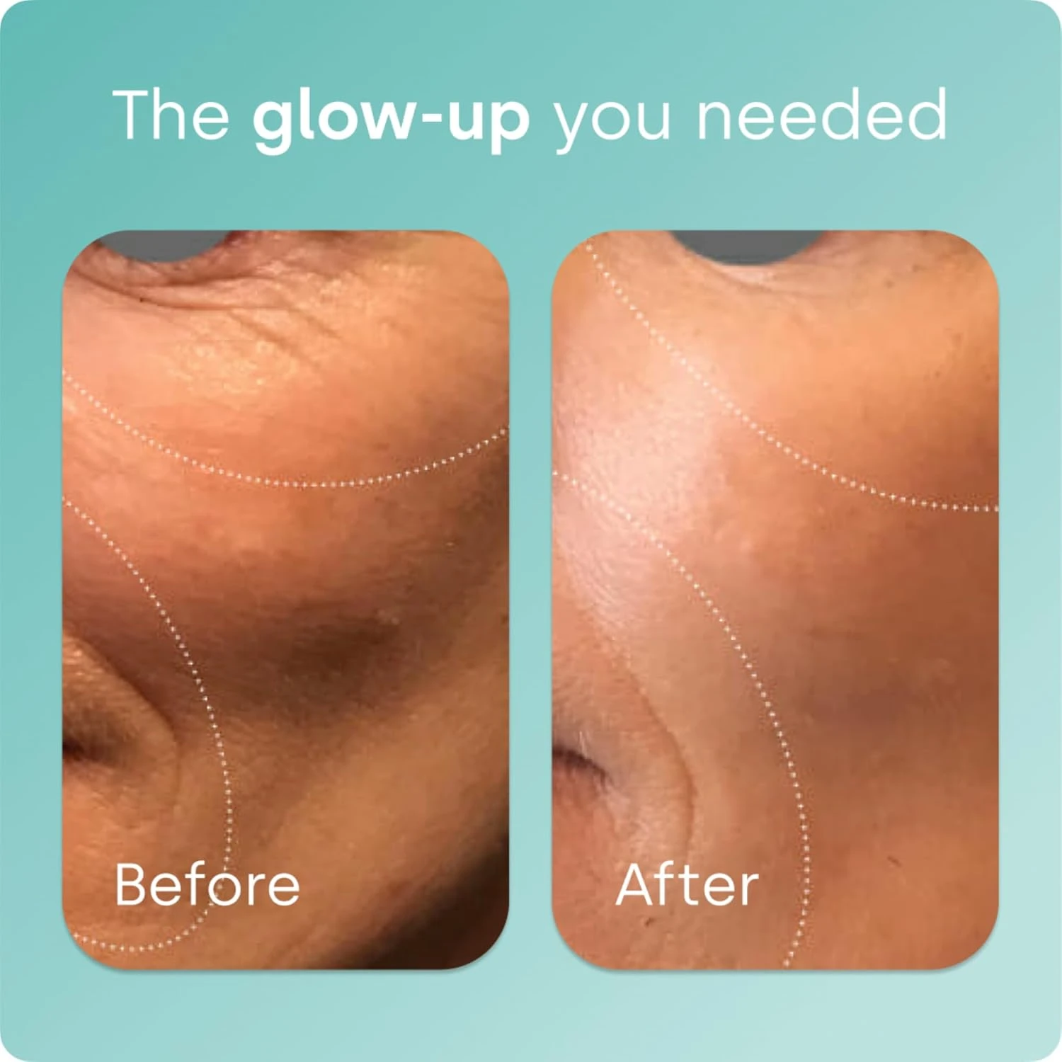 BioSil - 120 Vegan Capsules - with Patented ch-OSA Complex - Increase Collagen P