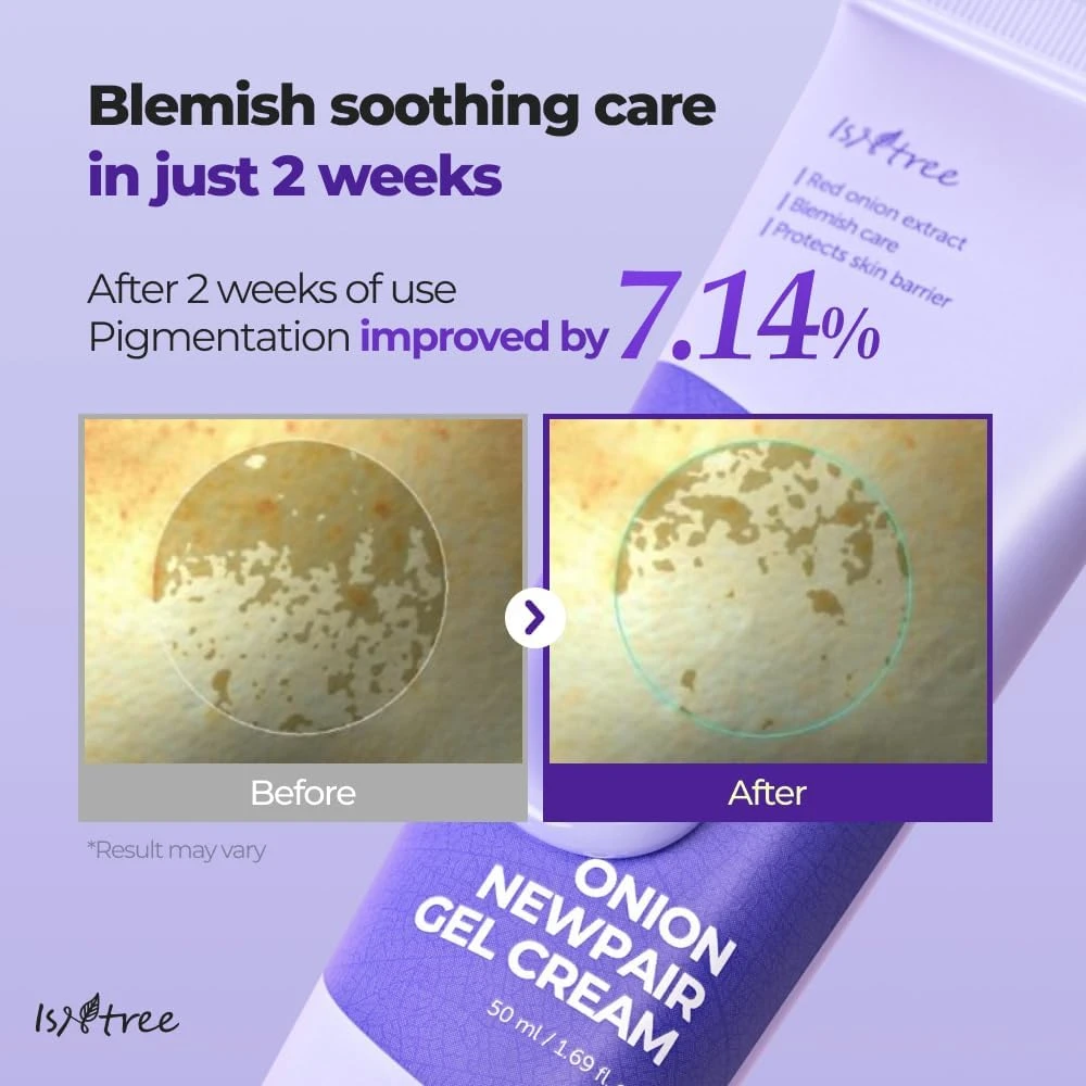 IsNtree Onion Newpair Gel Cream 50ml, 1.69 fl.oz | Soothing Care | Blemish & Spo